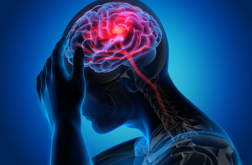 An xray image of a person holding their head. You can see their brain with red lines throughout.
